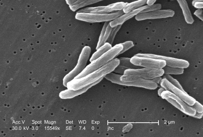 Mycobacterium tuberculosis 8438 lores